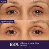 CAUDALIE PREMIER CRU - LA CREME CONTOUR DES YEUX 15ML