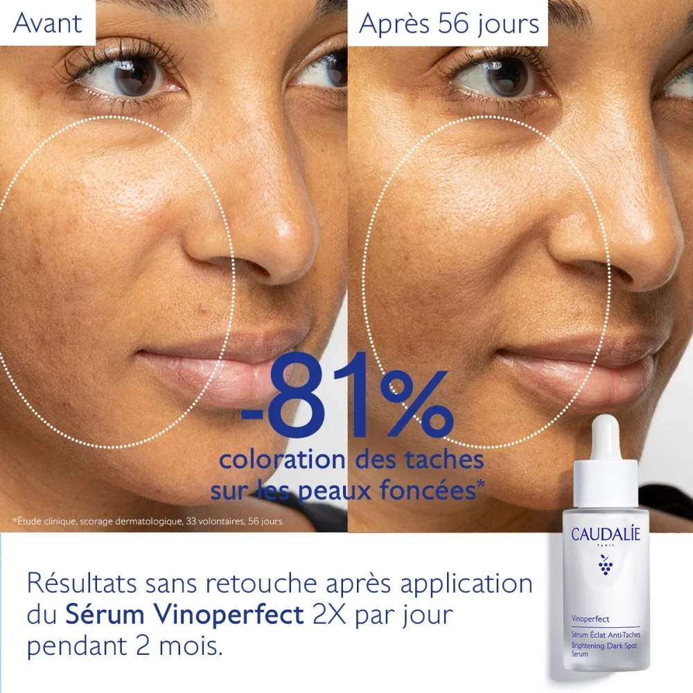 CAUDALIE VINOPERFECT - SERUM ECLAT ANTI-TACHES 30ML