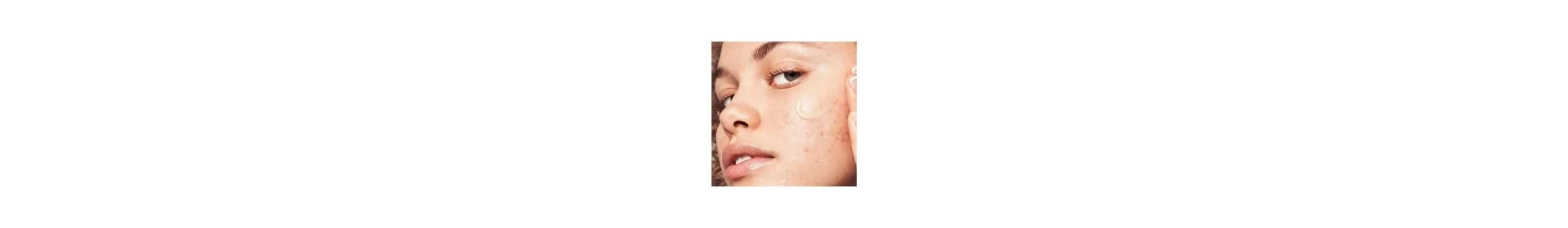 Anti-imperfections - Parapharmacie en Ligne - Para Fendri