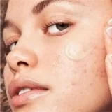 Anti-imperfections