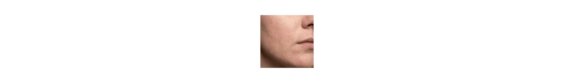 Creme Hydratante peaux seches - Parapharmacie en Ligne - Para Fendri